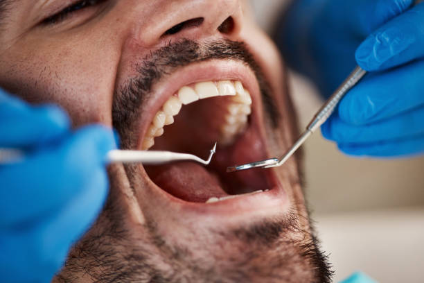 Full Mouth Reconstruction in Hillsboro, OR